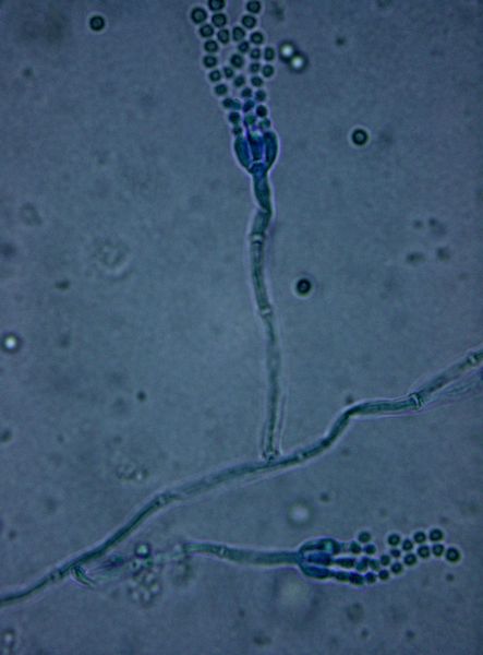 penicillium roqueforti mould